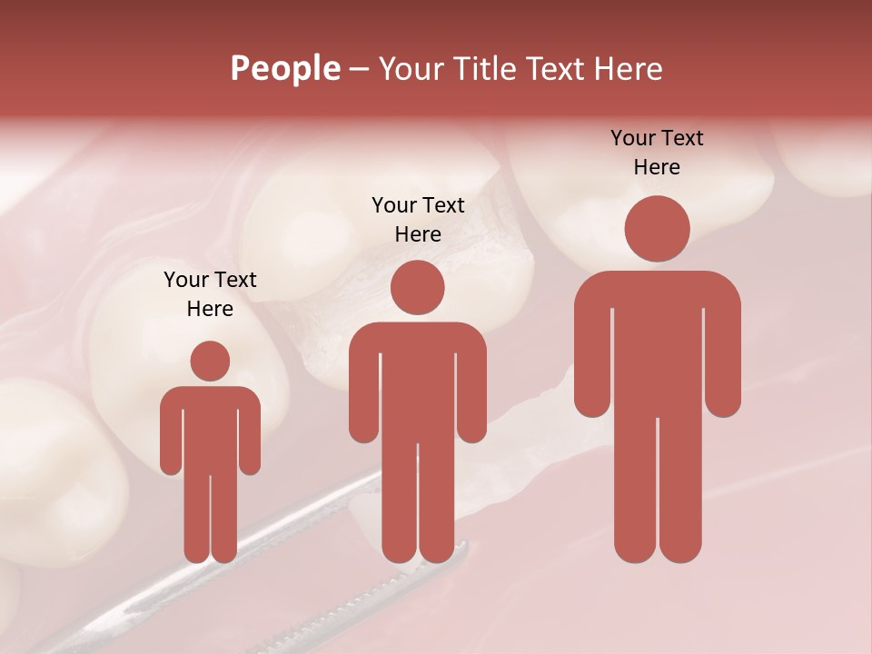 Periodontosis Dentist Ceramics PowerPoint Template