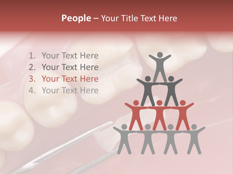 Periodontosis Dentist Ceramics PowerPoint Template