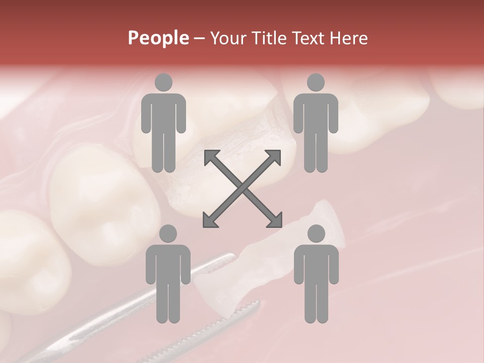 Periodontosis Dentist Ceramics PowerPoint Template