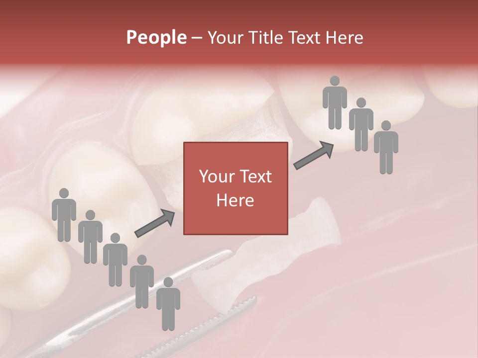 Periodontosis Dentist Ceramics PowerPoint Template