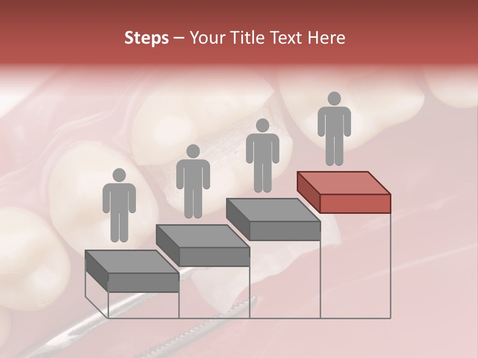 Periodontosis Dentist Ceramics PowerPoint Template