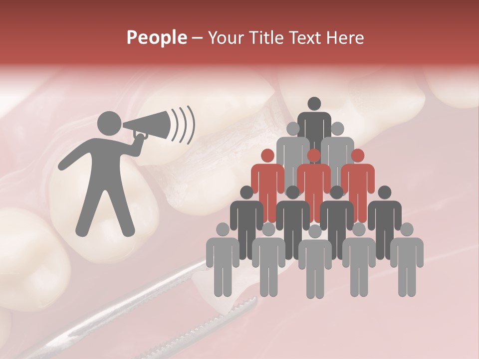 Periodontosis Dentist Ceramics PowerPoint Template