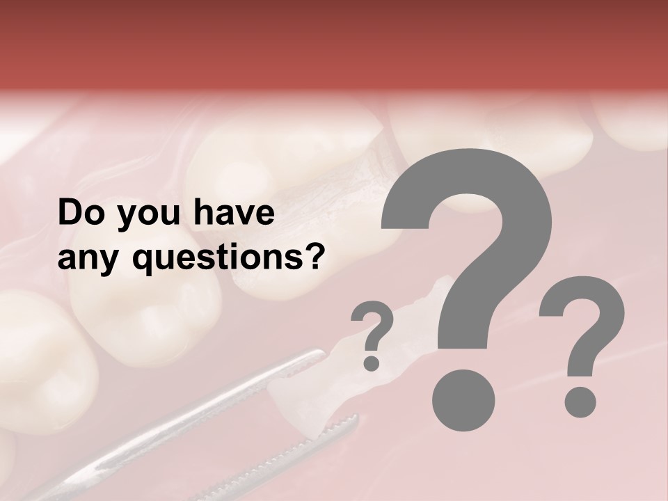 Periodontosis Dentist Ceramics PowerPoint Template