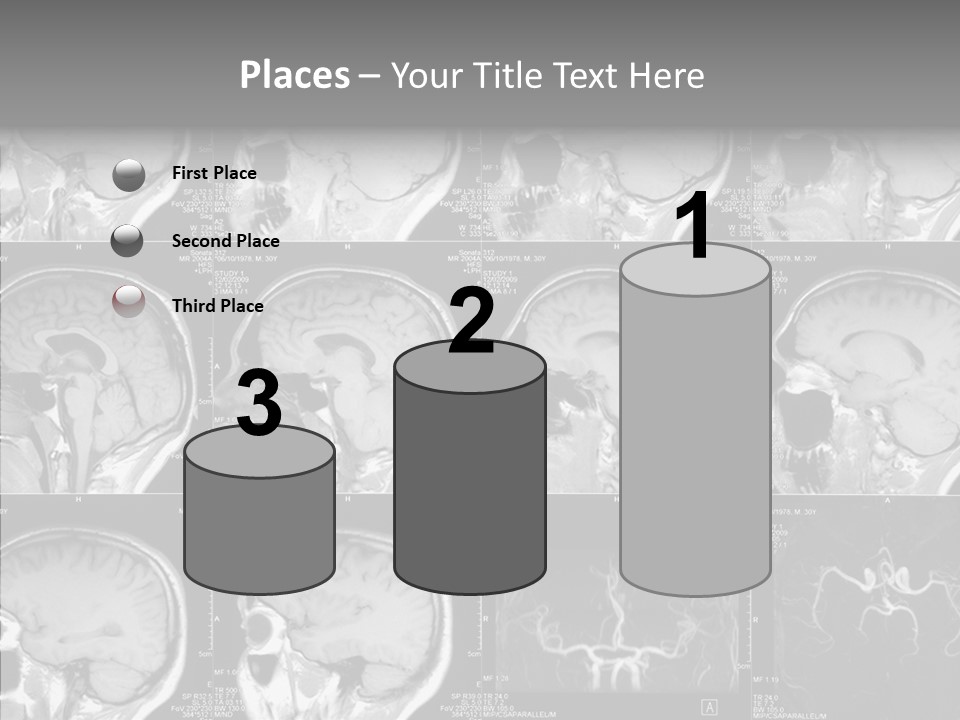 Elderly  Assist PowerPoint Template