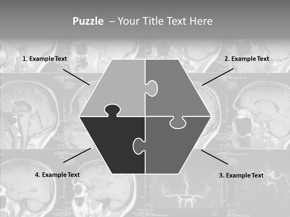 Elderly  Assist PowerPoint Template