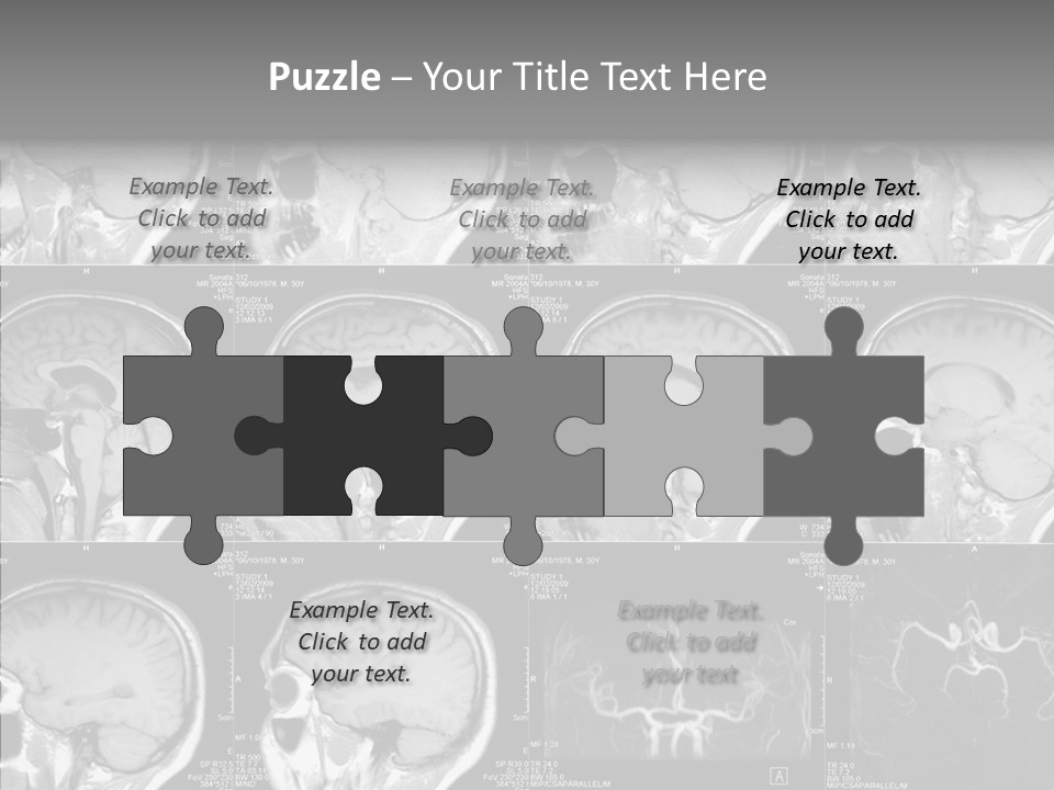 Elderly  Assist PowerPoint Template