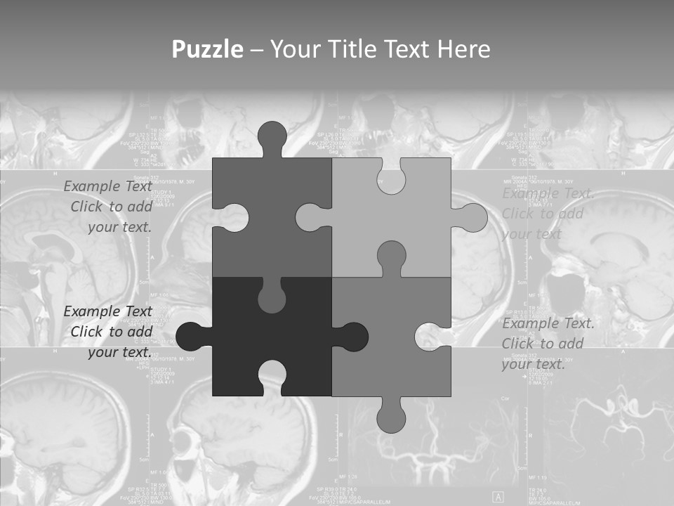 Elderly  Assist PowerPoint Template