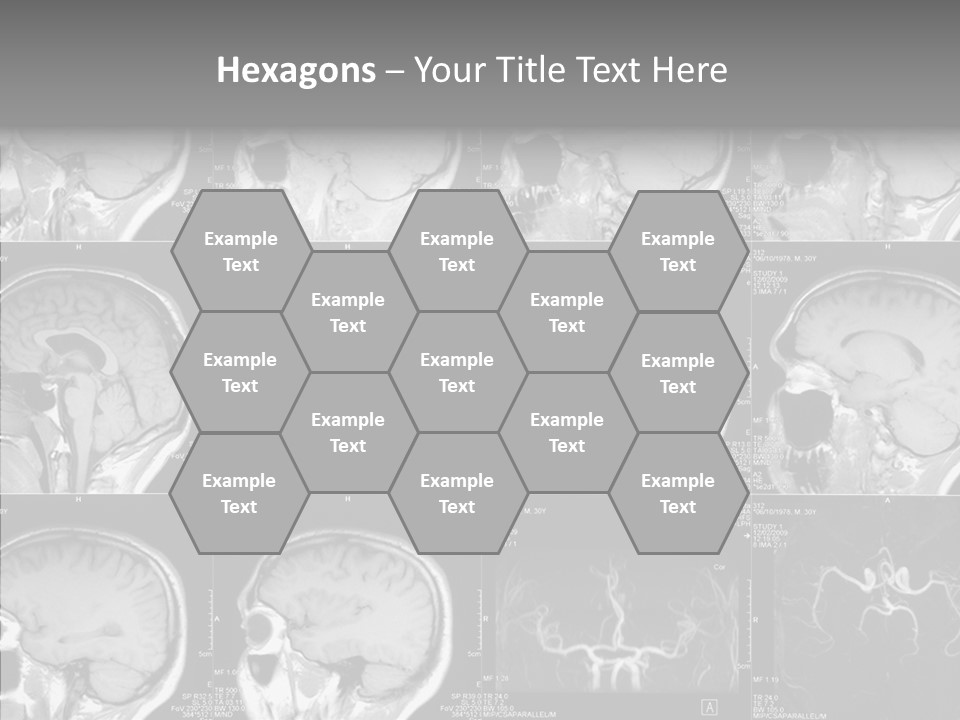 Elderly  Assist PowerPoint Template