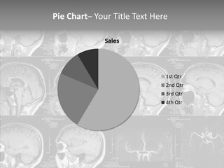 Elderly  Assist PowerPoint Template