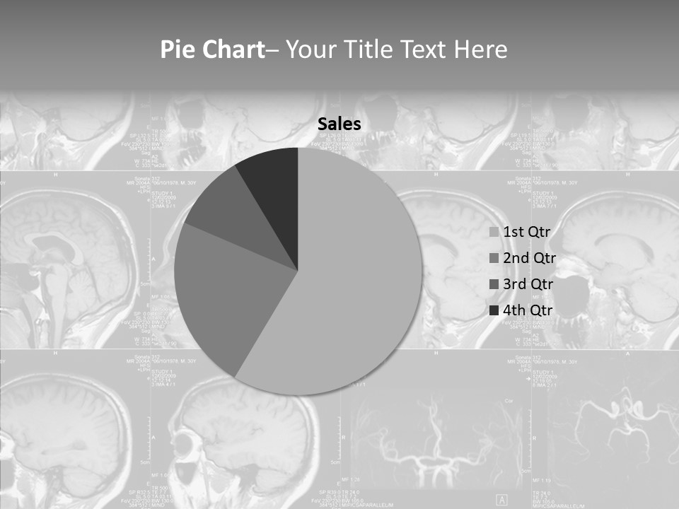 Elderly  Assist PowerPoint Template