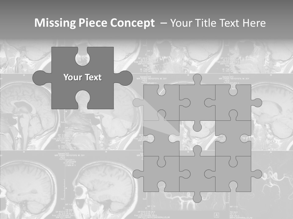 Elderly  Assist PowerPoint Template