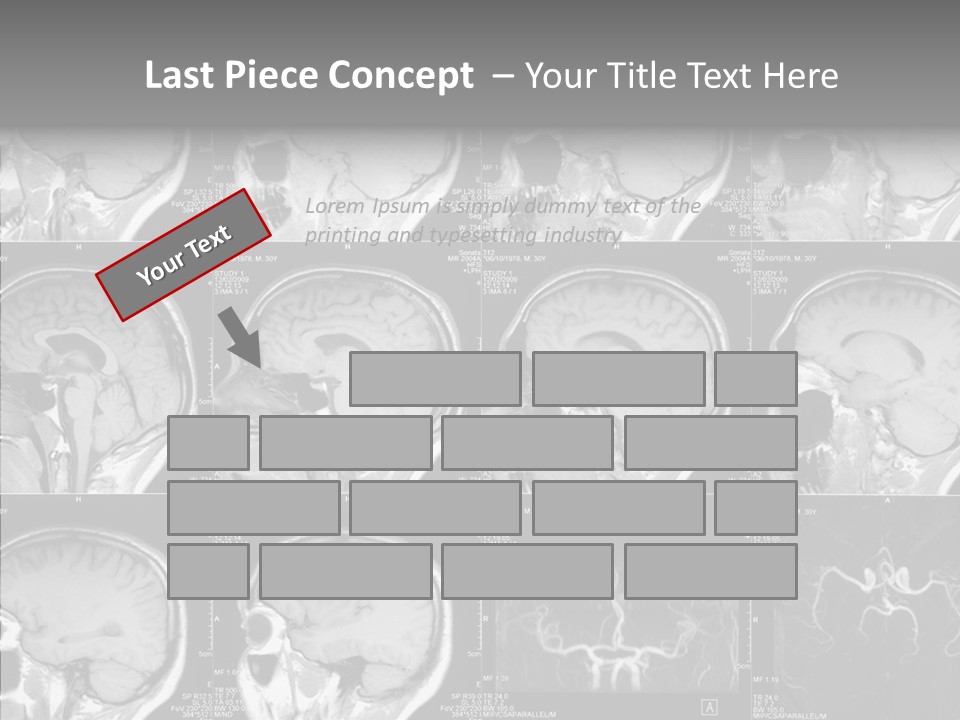 Elderly  Assist PowerPoint Template