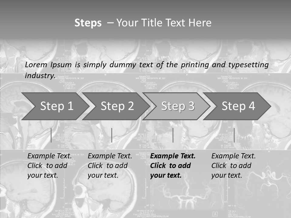 Elderly  Assist PowerPoint Template