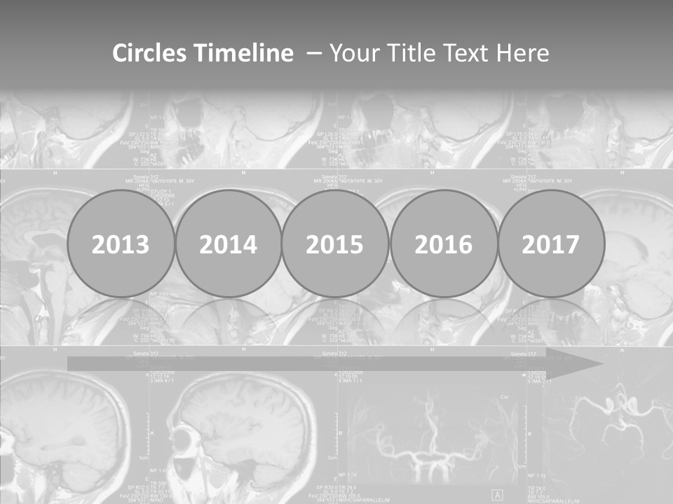 Elderly  Assist PowerPoint Template