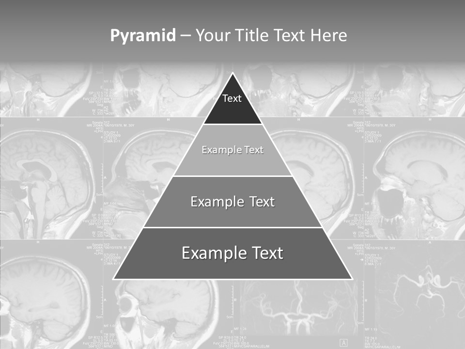 Elderly  Assist PowerPoint Template