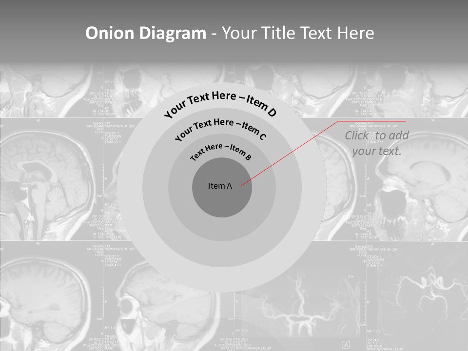 Elderly  Assist PowerPoint Template