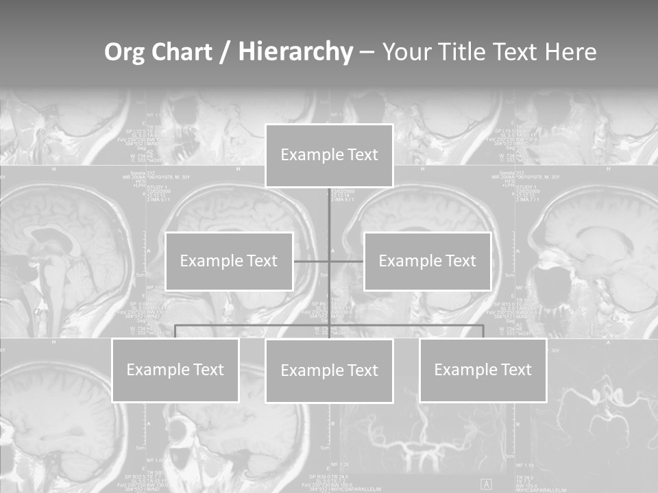 Elderly  Assist PowerPoint Template