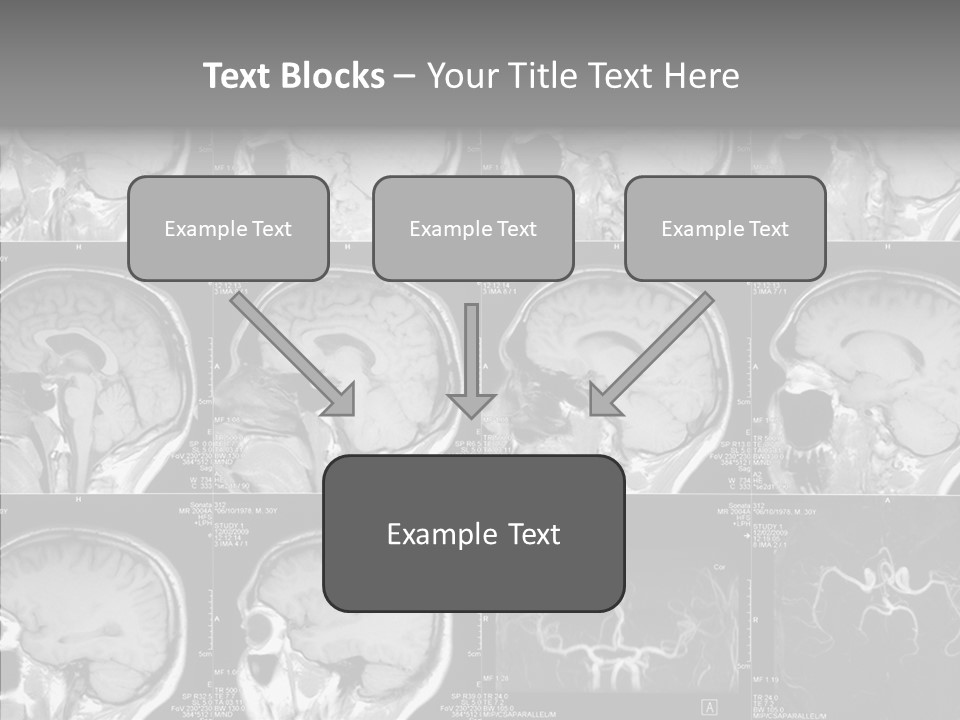 Elderly  Assist PowerPoint Template