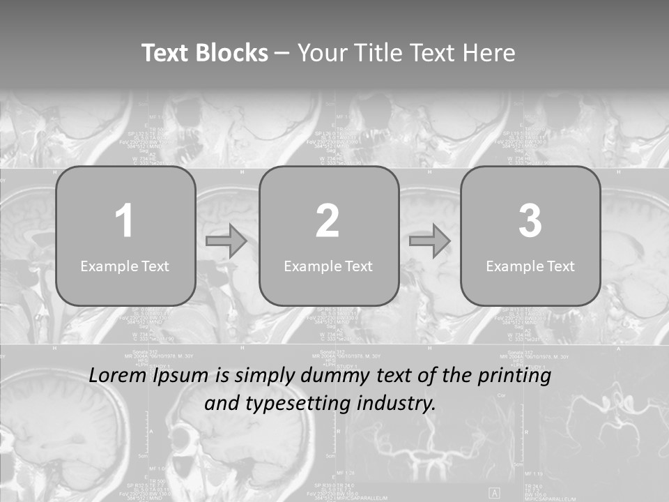 Elderly  Assist PowerPoint Template