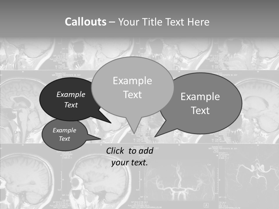 Elderly  Assist PowerPoint Template