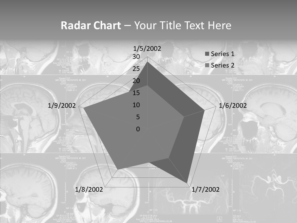 Elderly  Assist PowerPoint Template