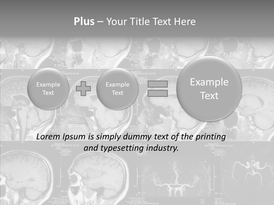 Elderly  Assist PowerPoint Template