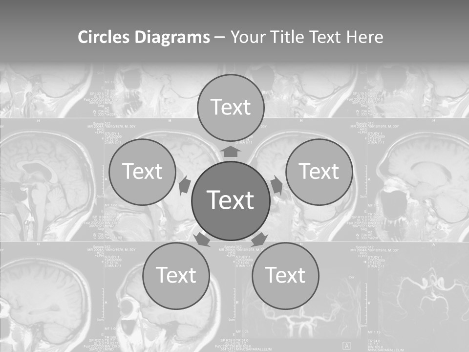 Elderly  Assist PowerPoint Template