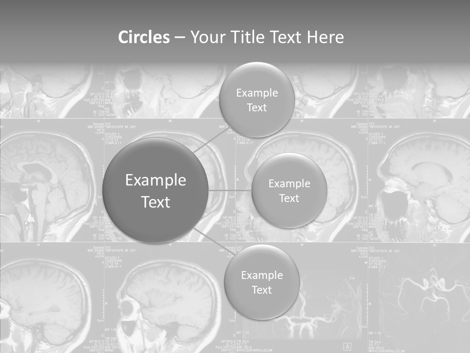 Elderly  Assist PowerPoint Template