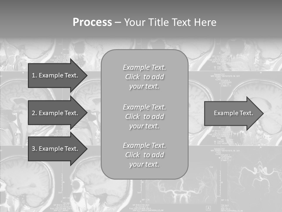 Elderly  Assist PowerPoint Template