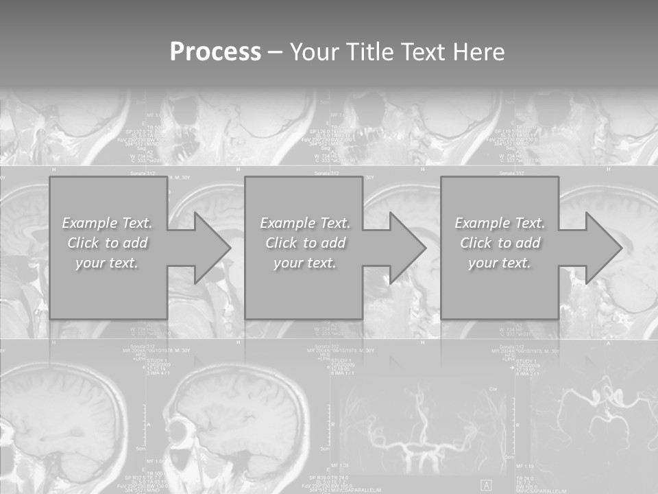 Elderly  Assist PowerPoint Template