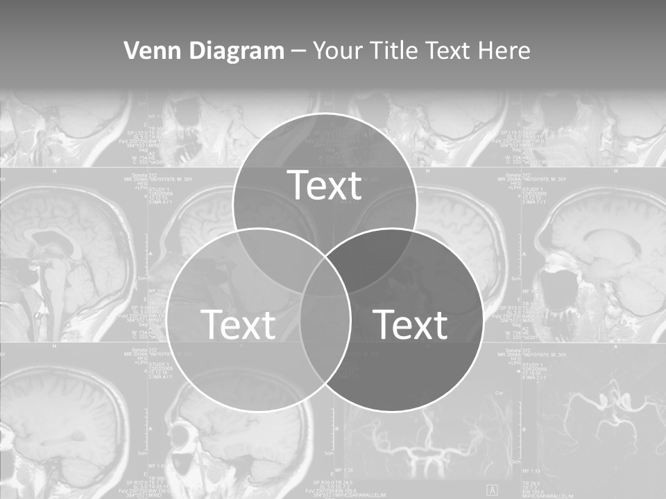 Elderly  Assist PowerPoint Template