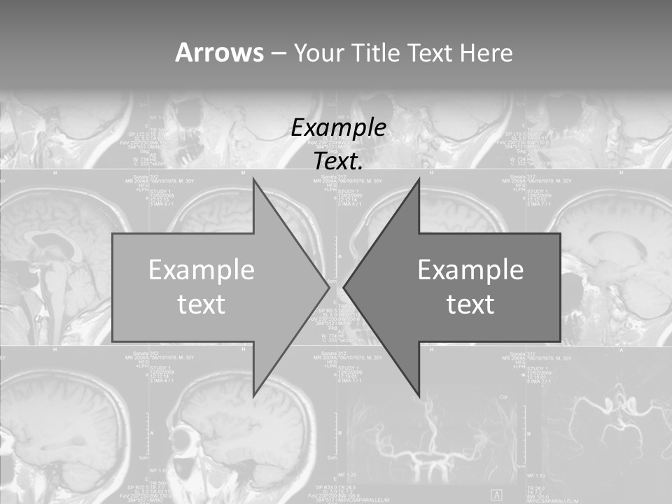 Elderly  Assist PowerPoint Template