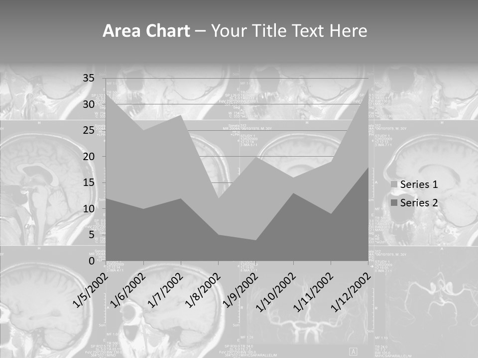 Elderly  Assist PowerPoint Template