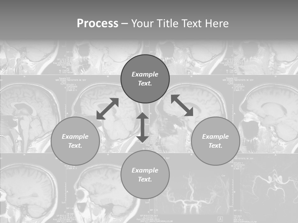 Elderly  Assist PowerPoint Template
