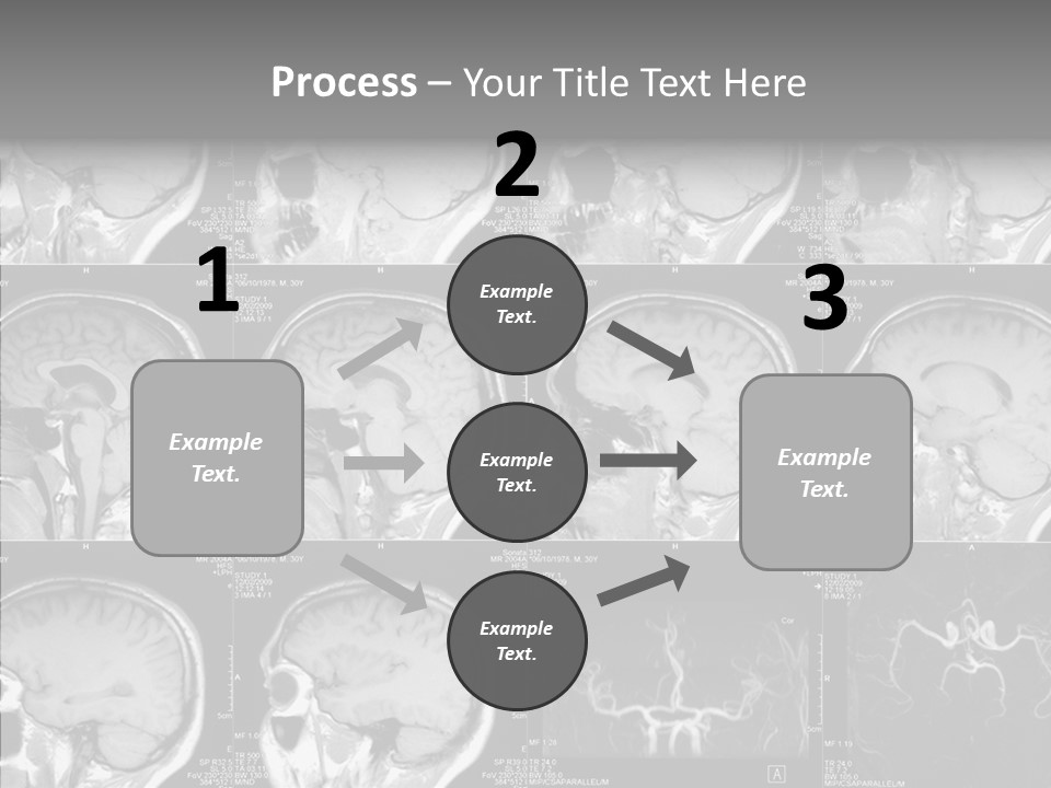 Elderly  Assist PowerPoint Template