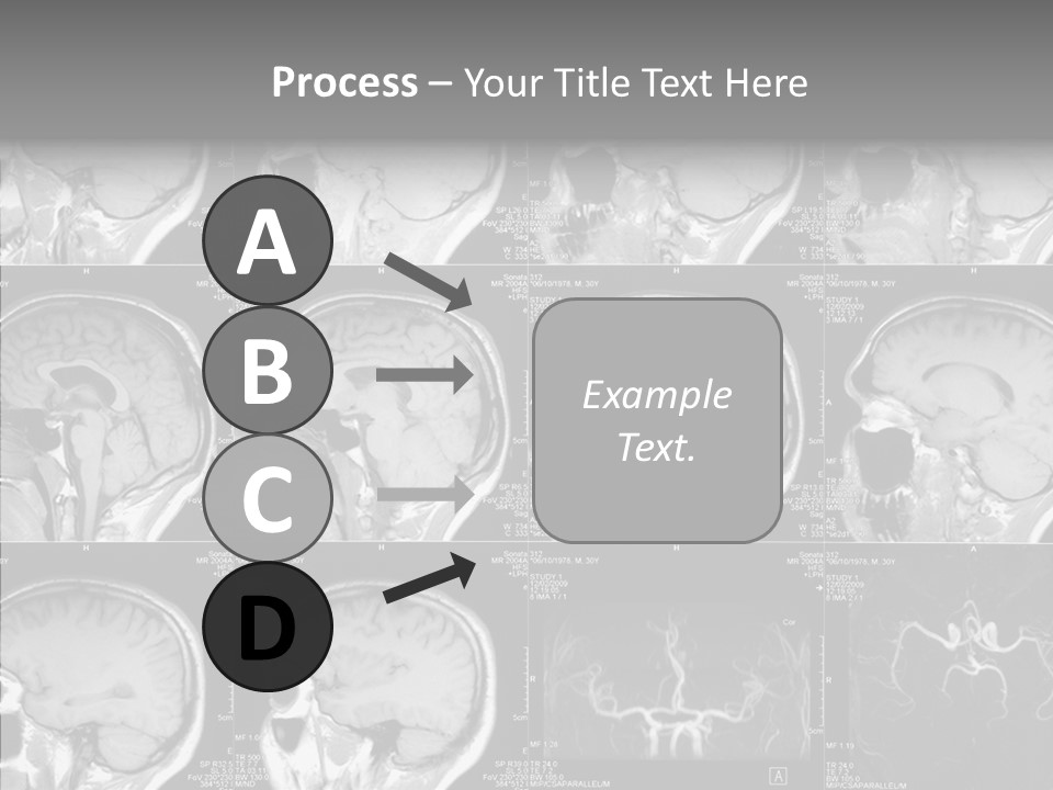 Elderly  Assist PowerPoint Template
