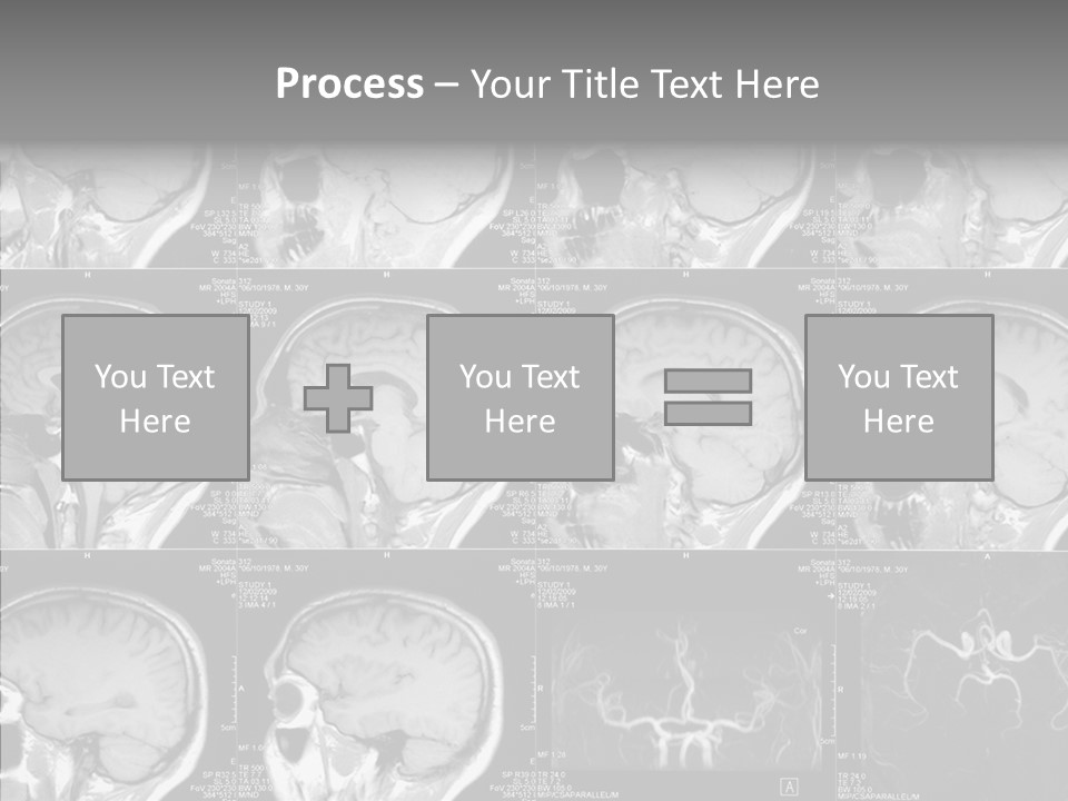 Elderly  Assist PowerPoint Template