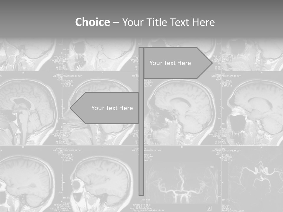 Elderly  Assist PowerPoint Template