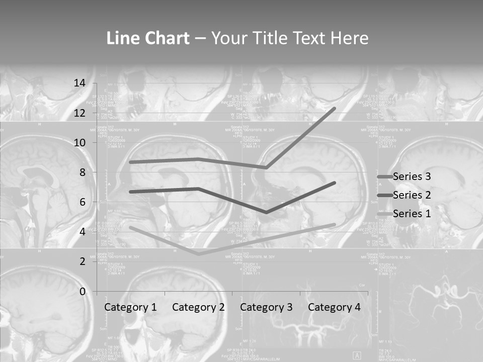 Elderly  Assist PowerPoint Template