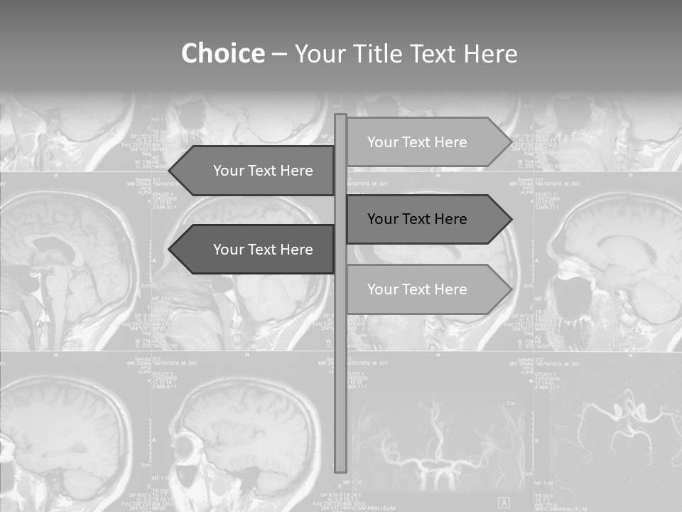 Elderly  Assist PowerPoint Template