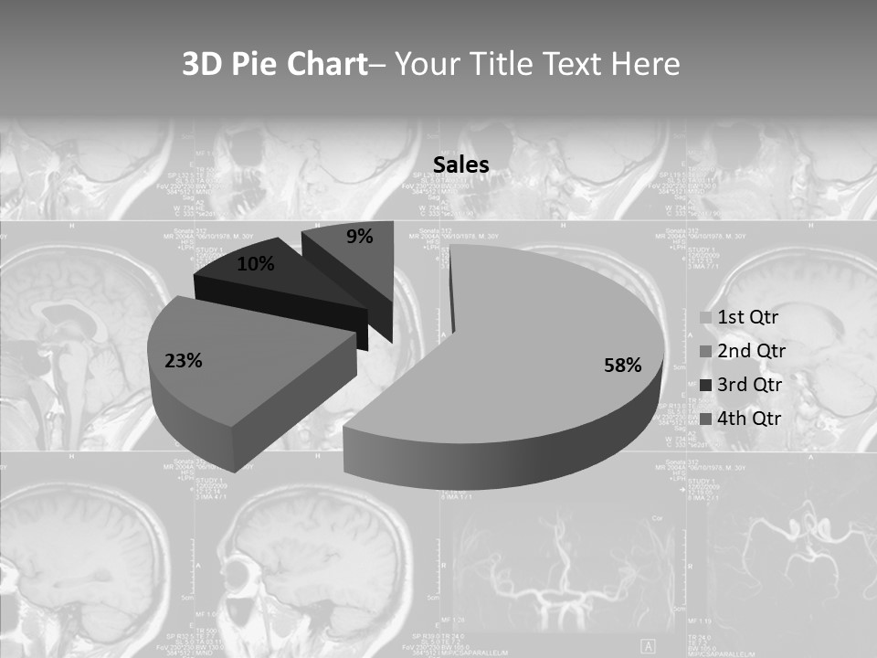 Elderly  Assist PowerPoint Template