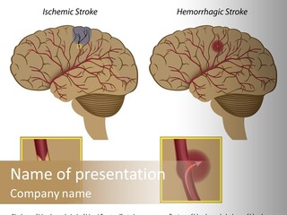 Problem Science Cerebral PowerPoint Template