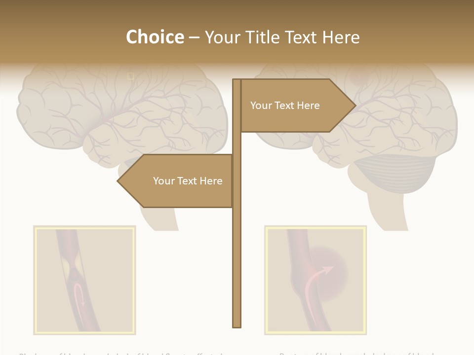 Problem Science Cerebral PowerPoint Template