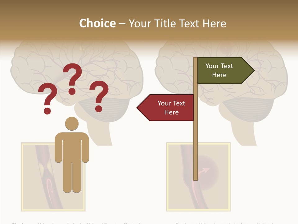 Problem Science Cerebral PowerPoint Template