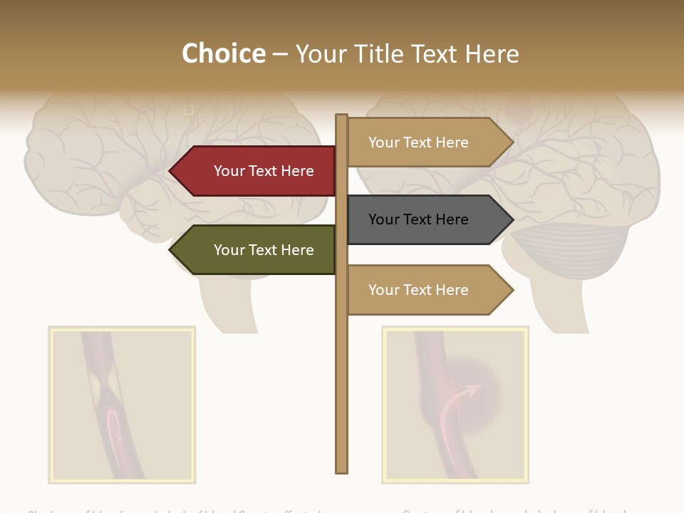 Problem Science Cerebral PowerPoint Template