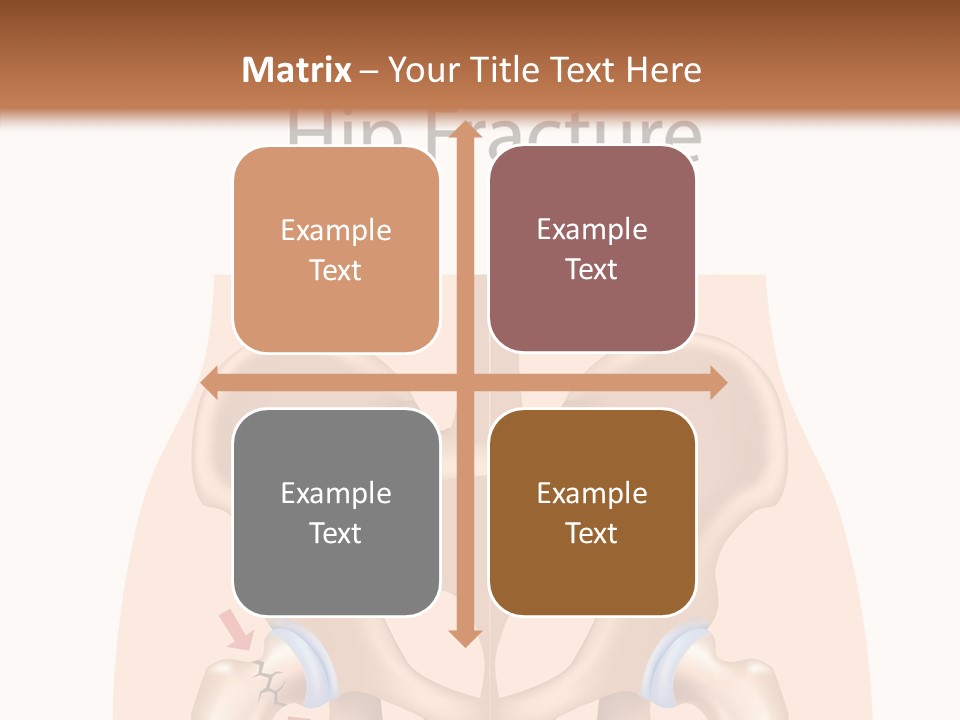 Injured Hip Illustration PowerPoint Template