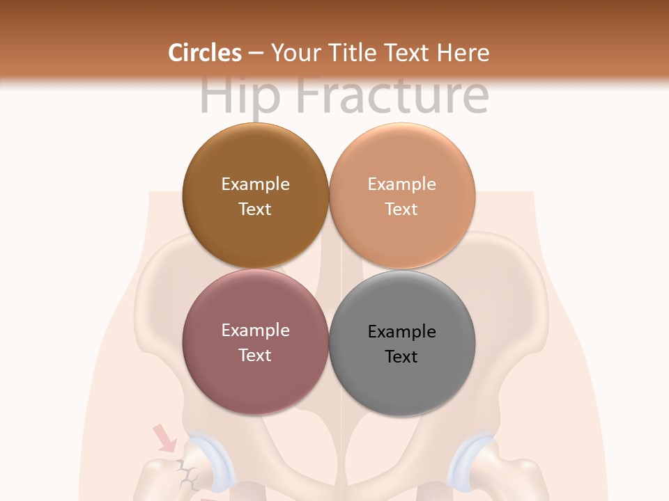 Injured Hip Illustration PowerPoint Template