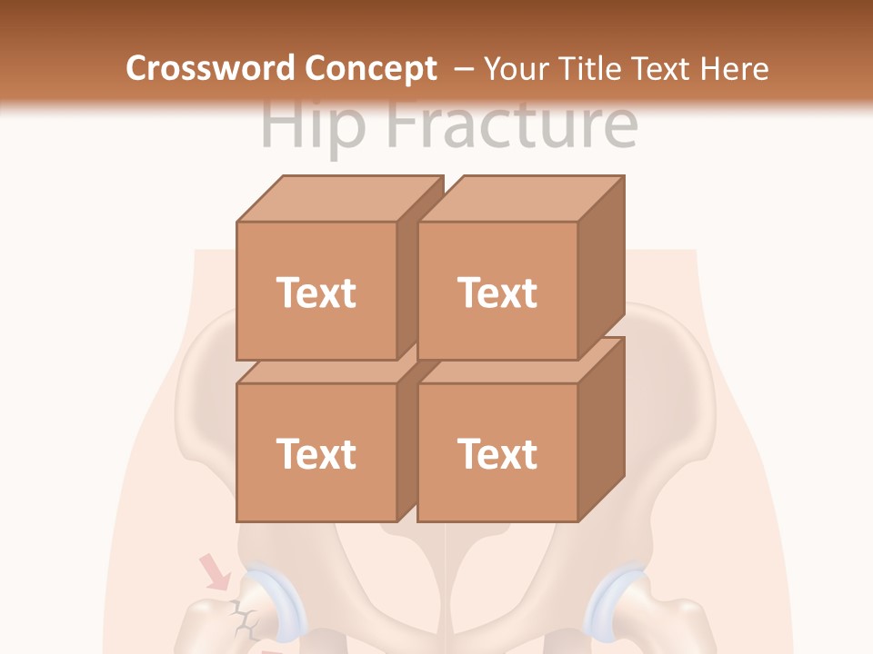 Injured Hip Illustration PowerPoint Template