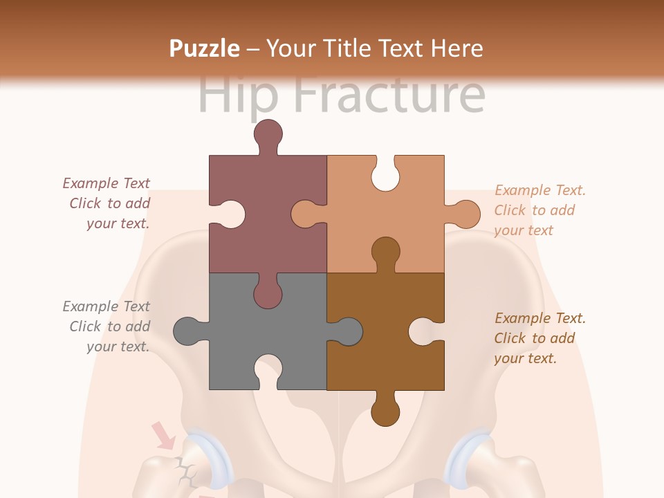 Injured Hip Illustration PowerPoint Template