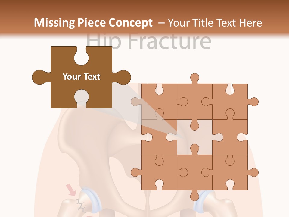 Injured Hip Illustration PowerPoint Template